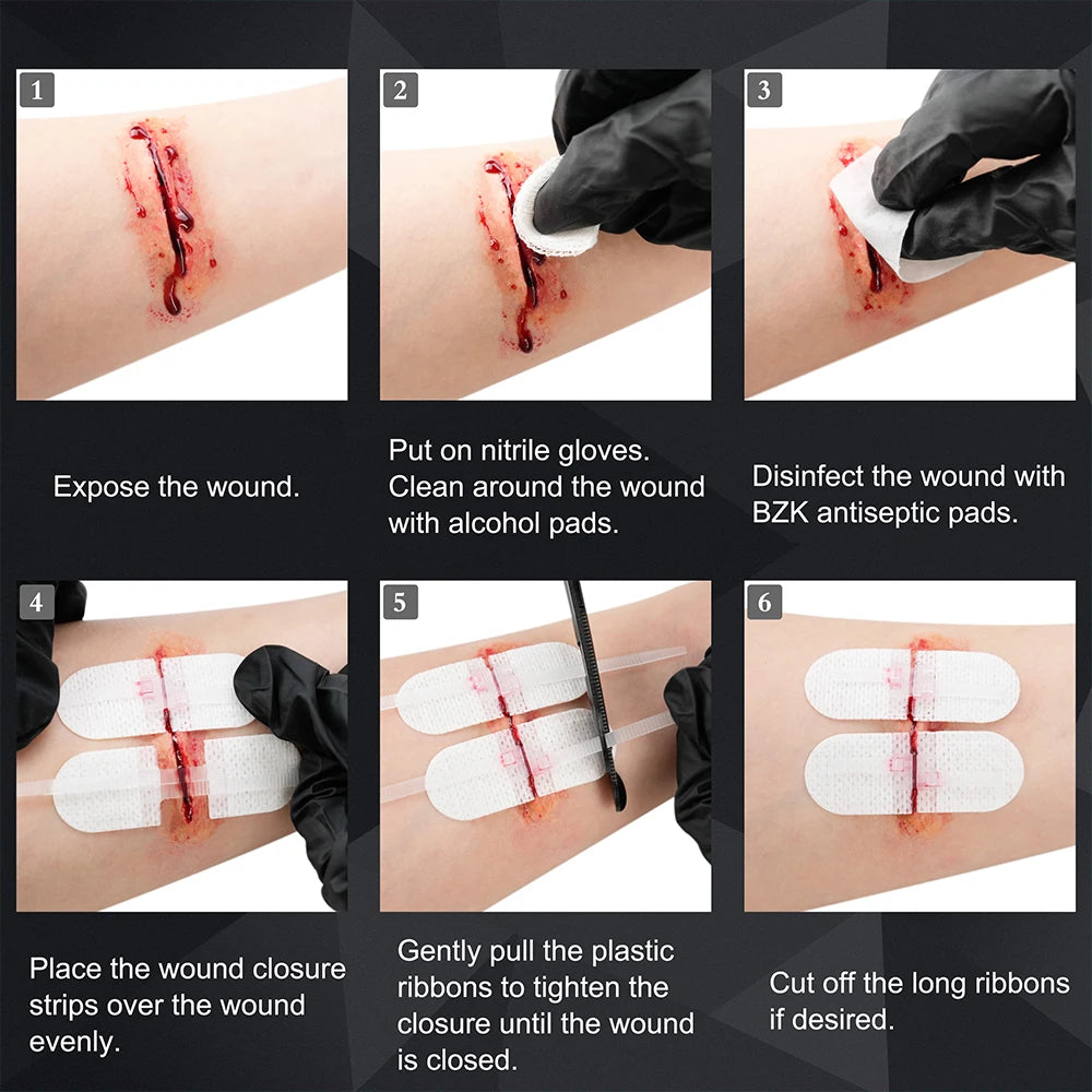Rhino Rescue Zip Stitch Laceration Closure Kit for Cut Care - Safety First Gear 25
