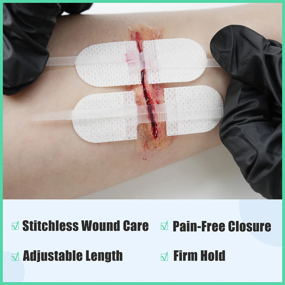 Rhino Rescue Zip Stitch Laceration Closure Kit for Cut Care - Safety First Gear 25